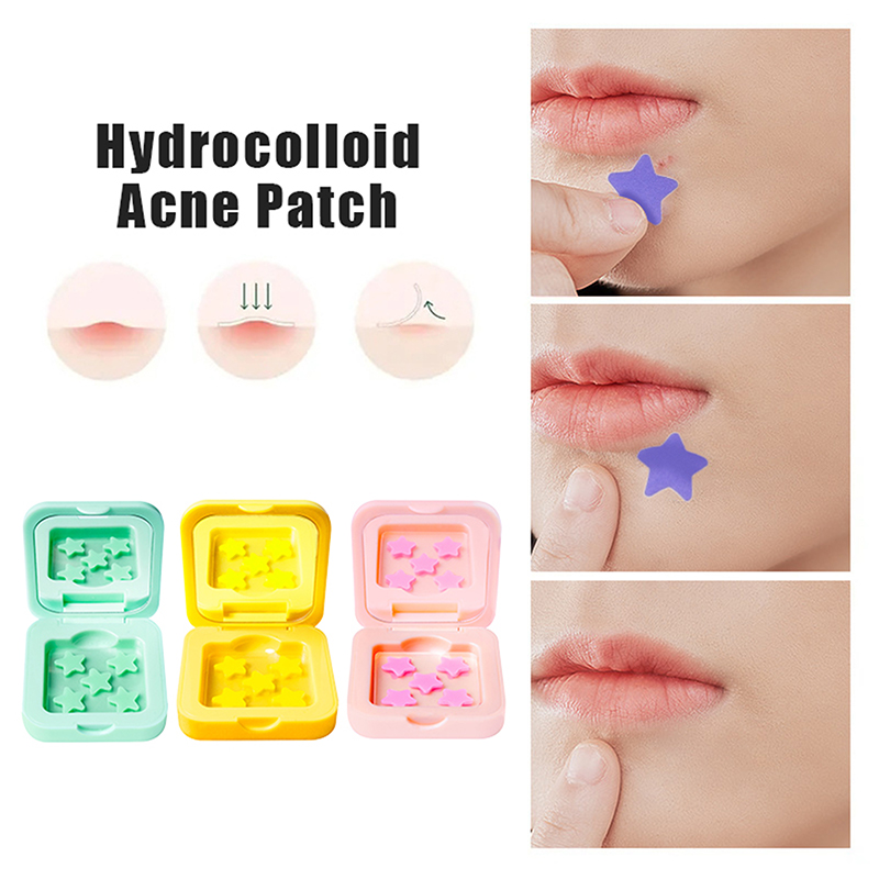 1Box Hydrokolloid Akne Patch V – Glass Break Detector Bewertung und Preis